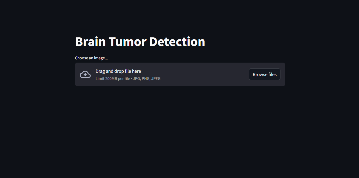 Brain Tumor Detection on MRI Images